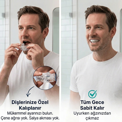 Horlama Karşıtı Ağızlık